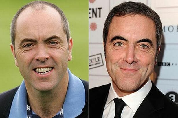 James Nesbitt Hair Transplant The Treatment Rooms London