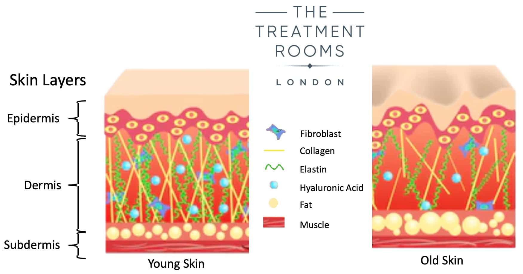 skin-structure-and-layers-skin-structure-dermal-fillers-layers-of-skin