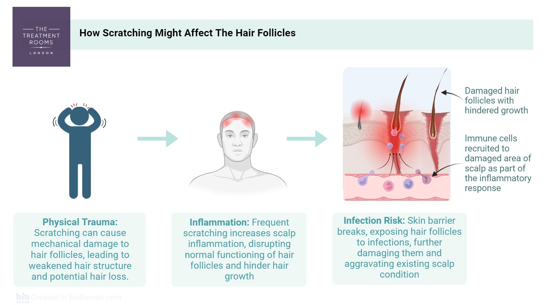 scalp eczema scratching hair loss